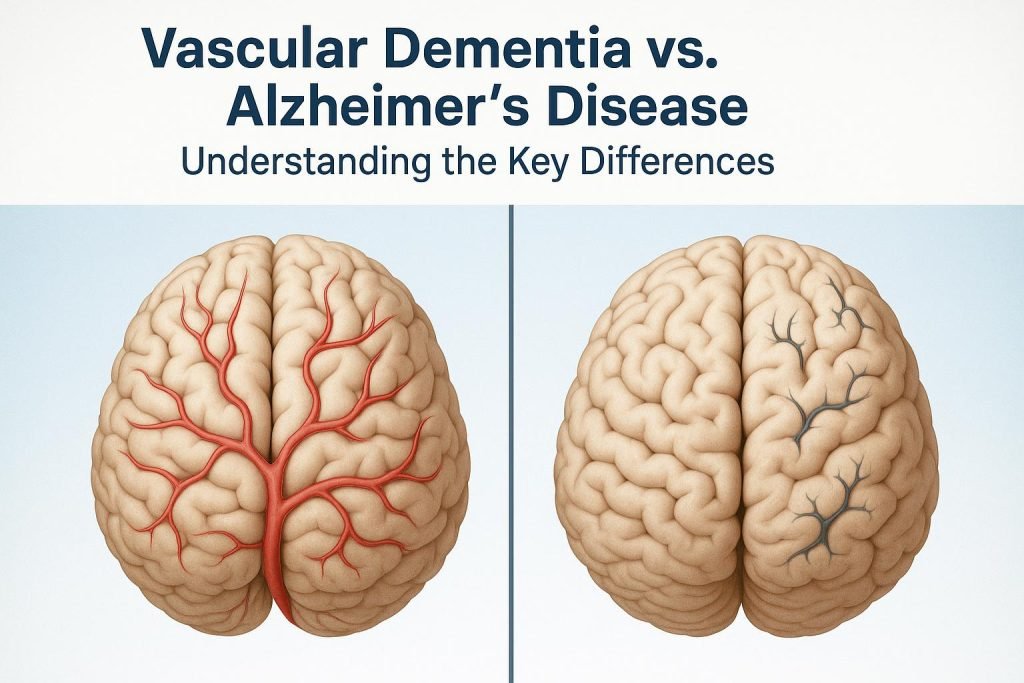 Vascular Dementia vs. Alzheimer’s Disease