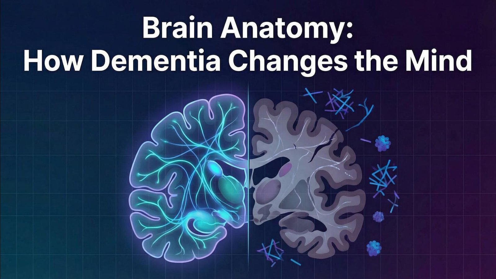 Brain Anatomy: How Dementia Changes the Mind